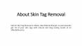 About Skin Tags Removal PowerPoint PPT Presentation