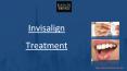 Invisalign Treatment PowerPoint PPT Presentation