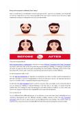 Hair Transplant In Hyderabad PowerPoint PPT Presentation