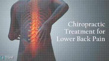 Chiropractor for Lower Back Pain in Burlington