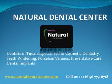 Dental implants Tijuana Mexico
