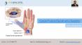 Carpal Tunnel Syndrome Surgery by Dr Chirag Patel PowerPoint PPT Presentation