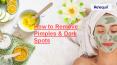 How to Remove Dark Spots and Pimples PowerPoint PPT Presentation