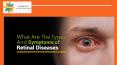 What Are The Types And Symptoms of Retinal Diseases PowerPoint PPT Presentation