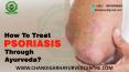 How To Treat Psoriasis Through Ayurveda? PowerPoint PPT Presentation