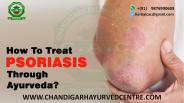 How To Treat Psoriasis Through Ayurveda?