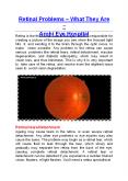 Retinal Problems – What They Are - Arohi Eye Hospital PowerPoint PPT Presentation