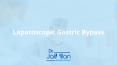 Laparoscopic Gastric Bypass Procedure PowerPoint PPT Presentation