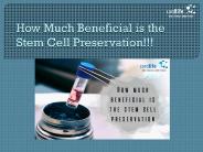 How Much Beneficial is the Stem Cell Preservation!!!