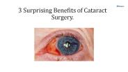 3 Surprising Benefits of Cataract Surgery.