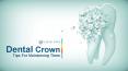 Dental Crown Tips For Maintaining Them PowerPoint PPT Presentation