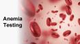 Anemia Testing in Dubai PowerPoint PPT Presentation
