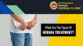 What Are The Types Of Hernia Treatment? PowerPoint PPT Presentation