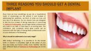 Three reasons you Should get a Dental Implant