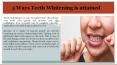5 Ways Teeth Whitening is attained PowerPoint PPT Presentation