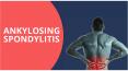 Win Arthritis – Ankylosing Spondylitis PowerPoint PPT Presentation