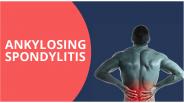 Win Arthritis – Ankylosing Spondylitis