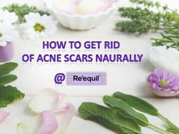 Home Remedies to Get Rid of Acne Scars