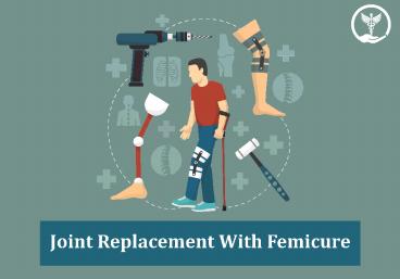 PPT – Knee replacement PowerPoint presentation | free to download - id ...