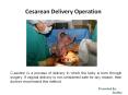 Cesarean Delivery in India PowerPoint PPT Presentation