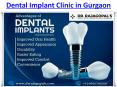 Get Dental Implant Clinic And Braces Treatment Children's Dental Clinic in Gurgaon PowerPoint PPT Presentation