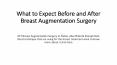 What to Expect Before and After Breast Augmentation Surgery PowerPoint PPT Presentation