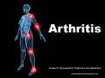 6 Best Homeopathic Medicines for ARTHRITIS,JOINTS PAIN, RHEUMATISM PowerPoint PPT Presentation