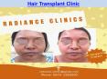 Hair Transplant Clinic PowerPoint PPT Presentation
