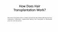 How Does Hair Transplantation Work? PowerPoint PPT Presentation