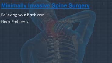 Minimally Invasive Spine Surgery - Relieving Your Back and Neck problems