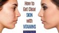 How to Get Clear Skin with Vitamins? PowerPoint PPT Presentation