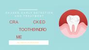 Cracked Tooth Syndrome - Causes and treatment