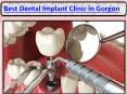 Dental Implant Treatment in Gurgaon | Dental Implants in Gurgaon PowerPoint PPT Presentation