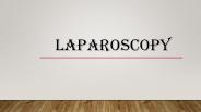 Laparoscopy