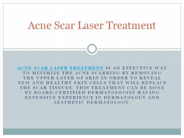 Acne Scar Laser Treatment