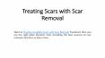 Treating Scars with Scar Removal PowerPoint PPT Presentation