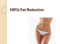 How HIFU Fat Reduction Is Winning Over Patients PowerPoint PPT Presentation