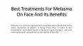 Best Treatments For Melasma On Face And Its Benefits PowerPoint PPT Presentation