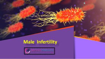 Male Infertility Centre in Hyderabad, Male Infertility Treatment In Hyderabad - Sridevi Fertility
