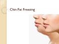 Women Roll Back The Years With Chin Fat Freezing - A Slimmer U PowerPoint PPT Presentation