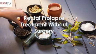 Rectal Prolapse Treatment Without Surgery
