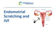 Endometrial Scratching and IVF