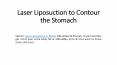 Laser Liposuction to Contour the Stomach PowerPoint PPT Presentation