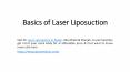 Basics of Laser Liposuction PowerPoint PPT Presentation