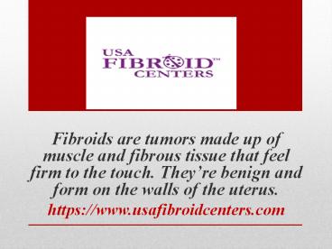 USA fibroid center