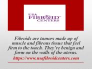 USA fibroid center