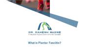 What Is Plantar Fasciitis