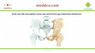 Women age-related bone density loss PPT | Meddco