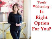 Teeth Whitening Is  Right Option For You ?