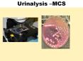 Urinalysis and Urine MCS PowerPoint PPT Presentation